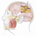 Minimalinvasive Trigeminusblockaden